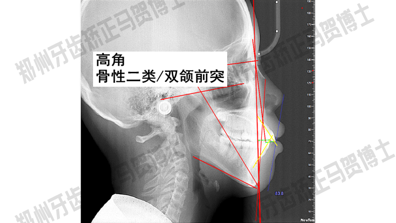 老师下面太紧拔不出来怎么矫正呢视频老师下面太紧拔不出来，如何矫正呢？-第2张图片