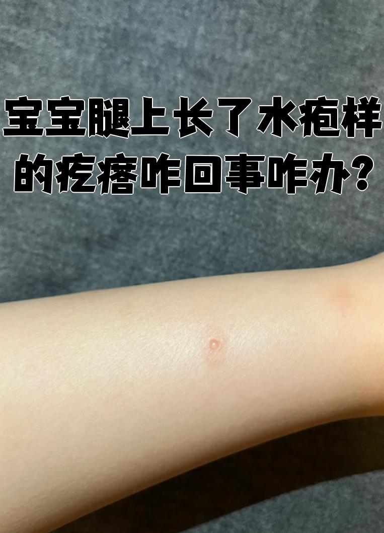宝宝腿抬起来就不疼了怎么回事宝宝腿抬起来不再疼痛-第2张图片