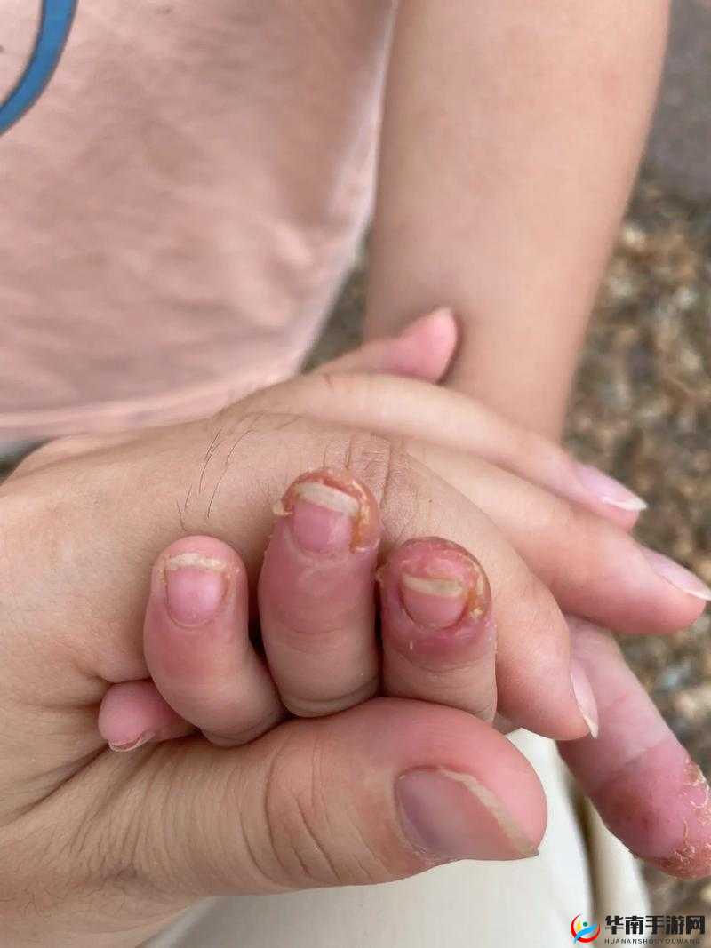 宝宝才两根手指就流了好多血宝宝才两根手指就流了