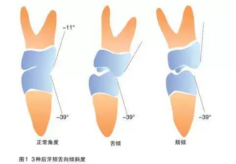 走一步故意深深地撞咬合在线观看故意咬合之步走